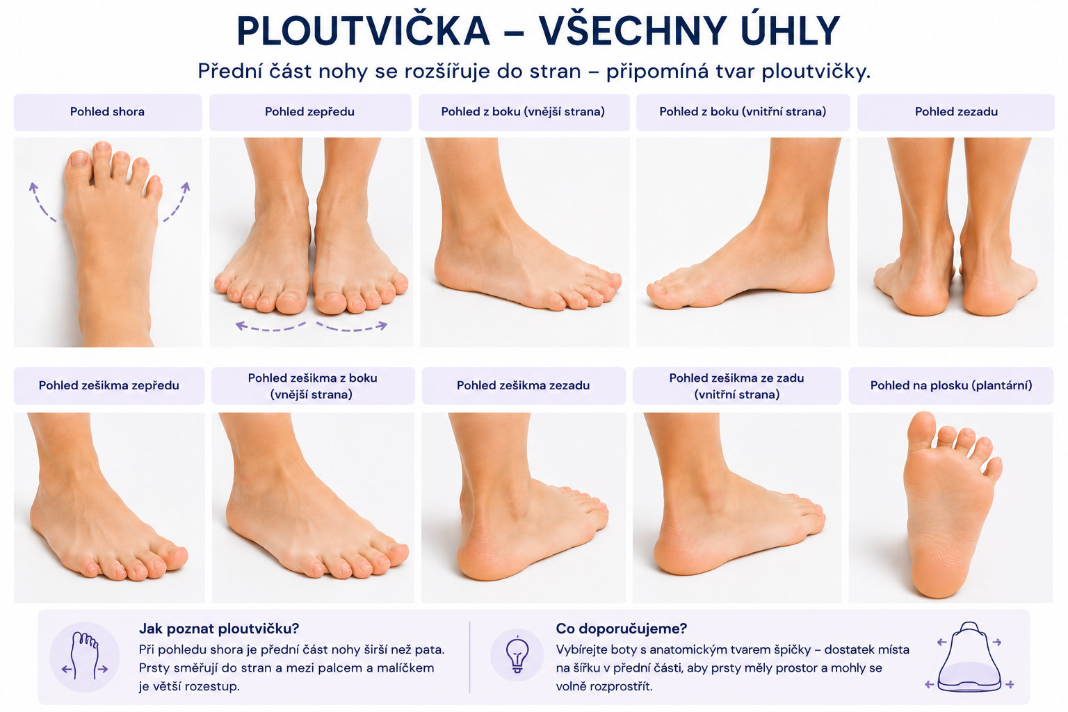 Ploutvička u dítěte – fotografie z různých úhlů